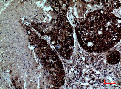 CD11d Antibody in Immunohistochemistry (Paraffin) (IHC (P))