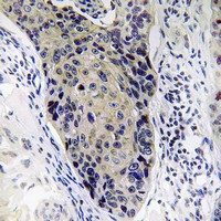 MRPL34 Antibody in Immunohistochemistry (Paraffin) (IHC (P))