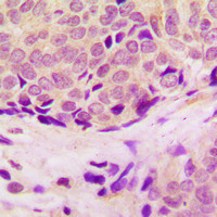 RPL37 Antibody in Immunohistochemistry (Paraffin) (IHC (P))