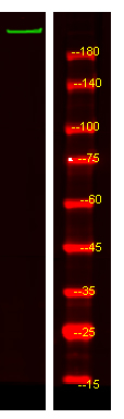 ADAMTS20 Antibody in Western Blot (WB)