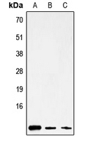 MT-ATP8 Antibody in Western Blot (WB)
