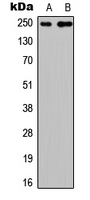 CABIN1 Antibody in Western Blot (WB)