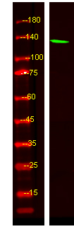 CAMTA2 Antibody in Western Blot (WB)