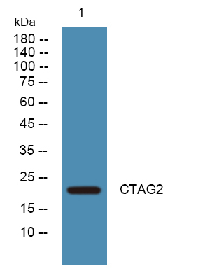 CTAG2 Antibody in Western Blot (WB)