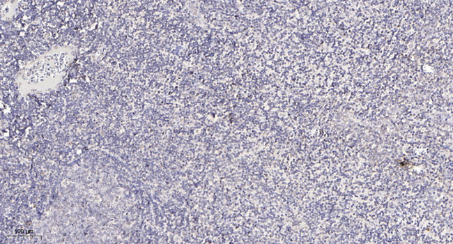 CEP250 Antibody in Immunohistochemistry (Paraffin) (IHC (P))