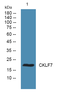CMTM7 Antibody in Western Blot (WB)