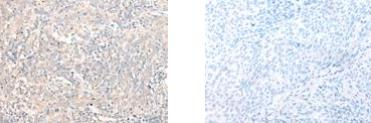 DHRS1 Antibody in Immunohistochemistry (Paraffin) (IHC (P))