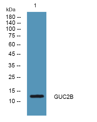 GUCA2B Antibody in Western Blot (WB)