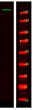 MYO5C Antibody in Western Blot (WB)