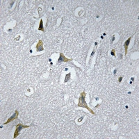 NDUFC1 Antibody in Immunohistochemistry (Paraffin) (IHC (P))