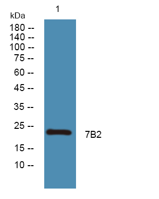 SCG5 Antibody in Western Blot (WB)