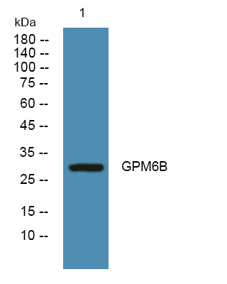 GPM6B Antibody in Western Blot (WB)