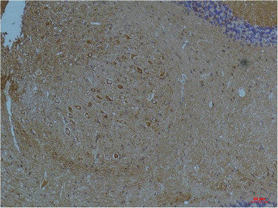 KCNH7 Antibody in Immunohistochemistry (Paraffin) (IHC (P))