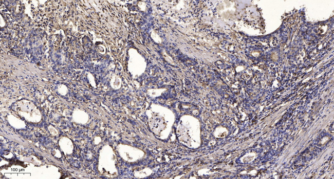 ARHGAP23 Antibody in Immunohistochemistry (Paraffin) (IHC (P))