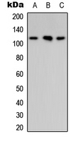 ARHGAP30 Antibody in Western Blot (WB)