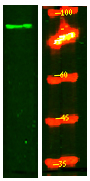 SLC9A2 Antibody in Western Blot (WB)