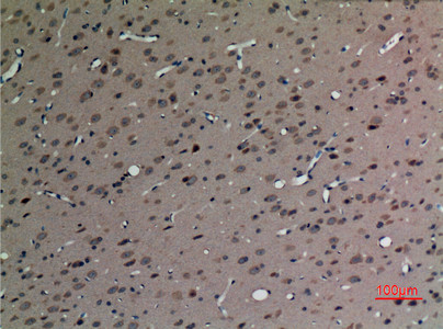 SV2C Antibody in Immunohistochemistry (Paraffin) (IHC (P))