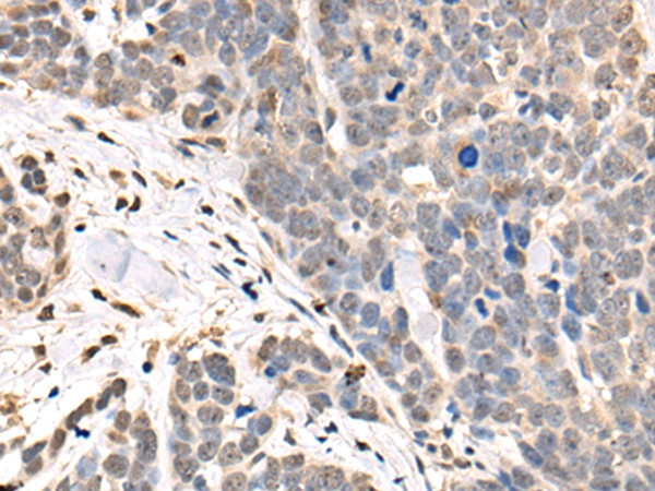 ASXL2 Antibody in Immunohistochemistry (Paraffin) (IHC (P))