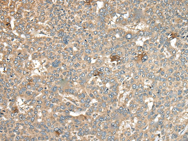 Carbonic Anhydrase XI Antibody in Immunohistochemistry (Paraffin) (IHC (P))