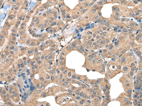 CABP5 Antibody in Immunohistochemistry (Paraffin) (IHC (P))