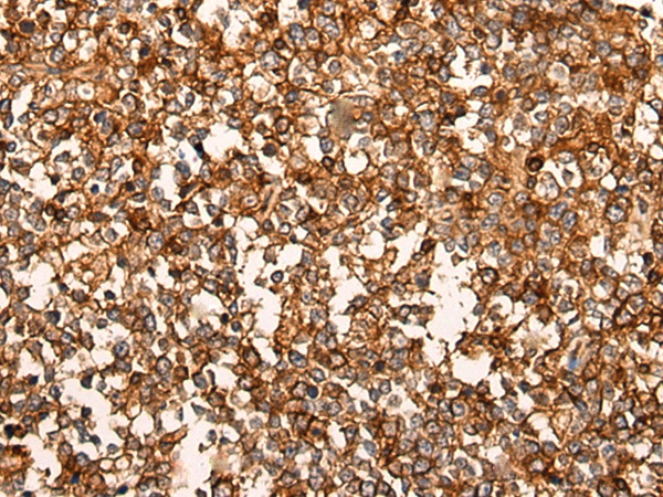 CACNA1B Antibody in Immunohistochemistry (Paraffin) (IHC (P))