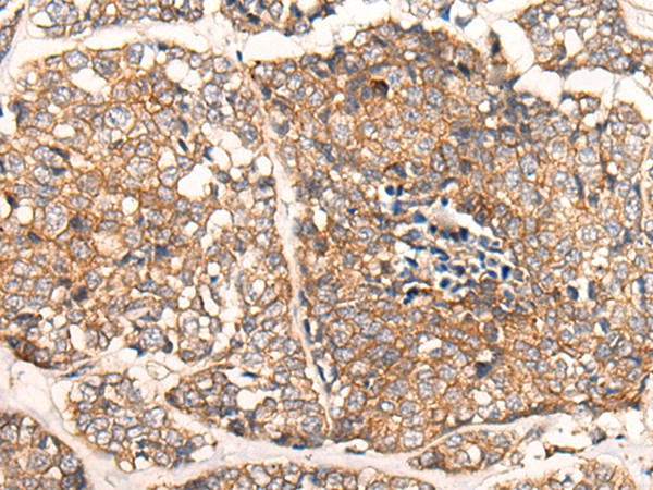 CACNA2D2 Antibody in Immunohistochemistry (Paraffin) (IHC (P))