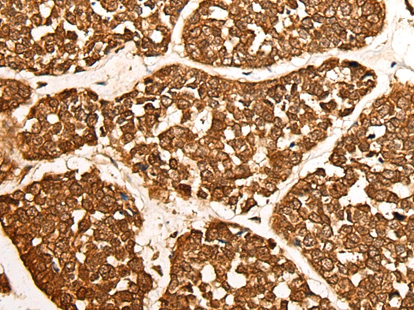 CALML6 Antibody in Immunohistochemistry (Paraffin) (IHC (P))