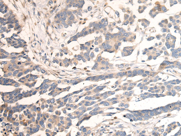 CAPN14 Antibody in Immunohistochemistry (Paraffin) (IHC (P))