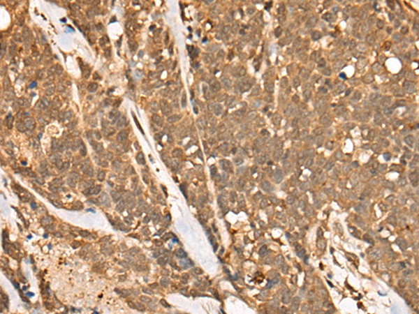 Calpain 15 Antibody in Immunohistochemistry (Paraffin) (IHC (P))