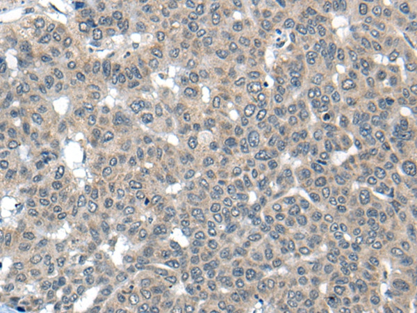 COP1 Antibody in Immunohistochemistry (Paraffin) (IHC (P))