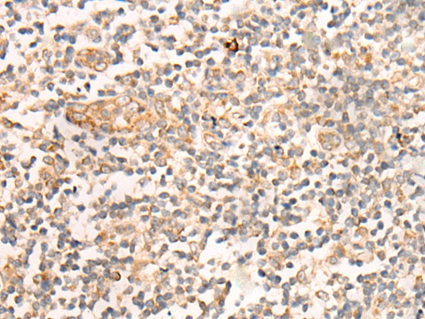 CASS4 Antibody in Immunohistochemistry (Paraffin) (IHC (P))