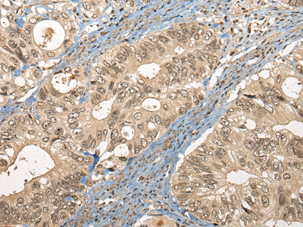 CC2D1A Antibody in Immunohistochemistry (Paraffin) (IHC (P))