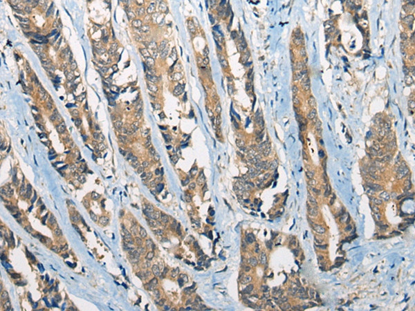 CCIN Antibody in Immunohistochemistry (Paraffin) (IHC (P))