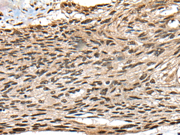CCNB1IP1 Antibody in Immunohistochemistry (Paraffin) (IHC (P))