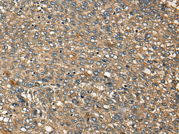 MRCK alpha Antibody in Immunohistochemistry (Paraffin) (IHC (P))