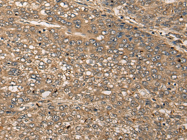 CDRT15L2 Antibody in Immunohistochemistry (Paraffin) (IHC (P))