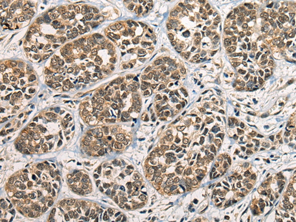 CECR6 Antibody in Immunohistochemistry (Paraffin) (IHC (P))