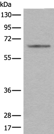 CENPT Antibody in Western Blot (WB)
