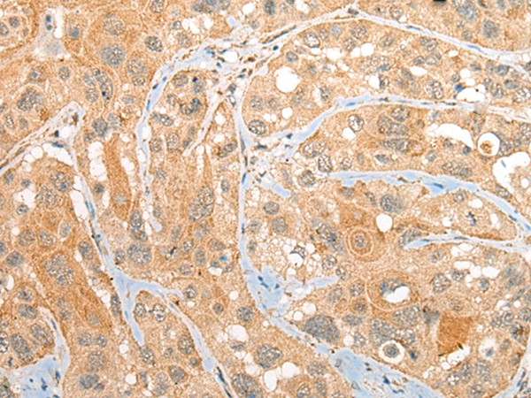 CEP72 Antibody in Immunohistochemistry (Paraffin) (IHC (P))