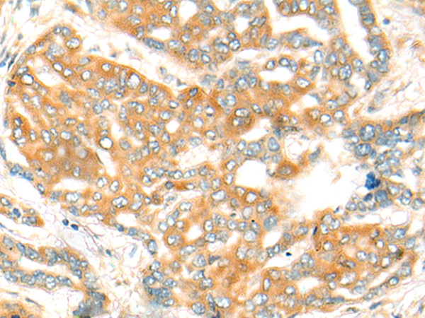 CFHR2 Antibody in Immunohistochemistry (Paraffin) (IHC (P))