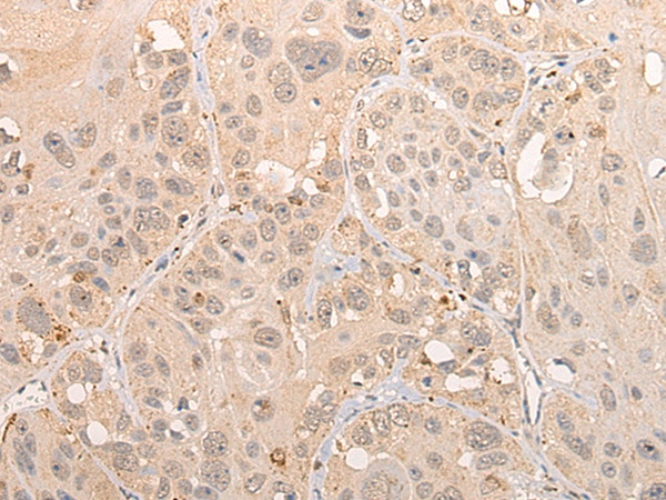 CINP Antibody in Immunohistochemistry (Paraffin) (IHC (P))