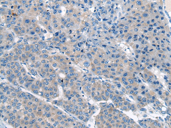 CITED4 Antibody in Immunohistochemistry (Paraffin) (IHC (P))