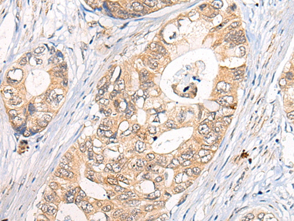 CLPTM1 Antibody in Immunohistochemistry (Paraffin) (IHC (P))