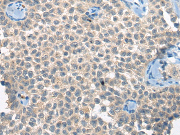 CLTCL1 Antibody in Immunohistochemistry (Paraffin) (IHC (P))