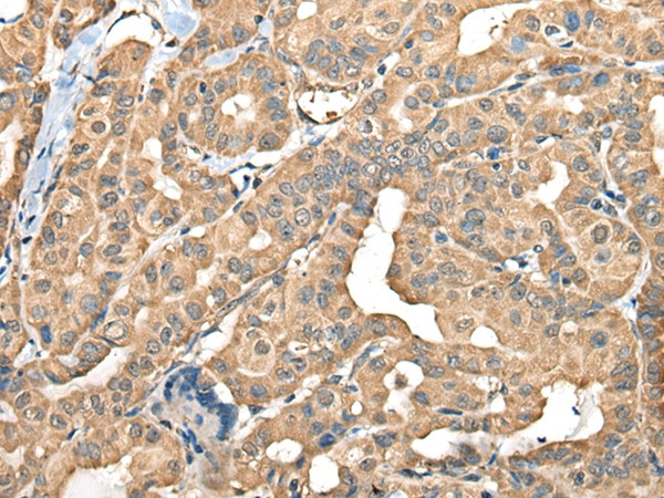 FAM110B Antibody in Immunohistochemistry (Paraffin) (IHC (P))