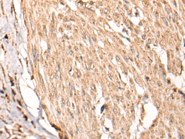 HSF4 Antibody in Immunohistochemistry (Paraffin) (IHC (P))