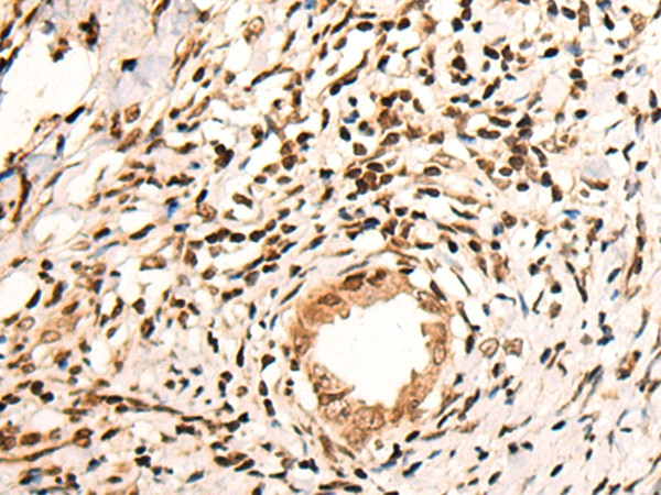 KMT2C Antibody in Immunohistochemistry (Paraffin) (IHC (P))