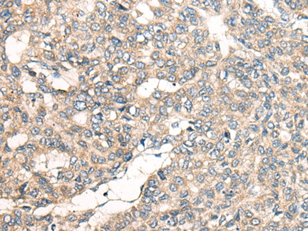 LRP1B Antibody in Immunohistochemistry (Paraffin) (IHC (P))