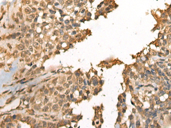 MEIOB Antibody in Immunohistochemistry (Paraffin) (IHC (P))