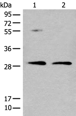 NAT8L Antibody in Western Blot (WB)